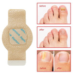 Nail Repair Patches With Tea Tree Oil For Fungal Treatment - Image 9