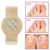 Nail Repair Patches With Tea Tree Oil For Fungal Treatment - Image 9